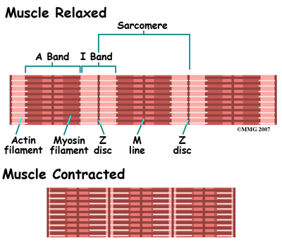 Causes of Muscle Cramps