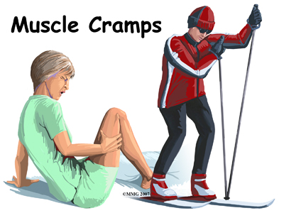 All About Muscle Cramps